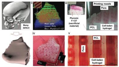 Safety Considerations in 3D Bioprinting Using Mesenchymal Stromal Cells